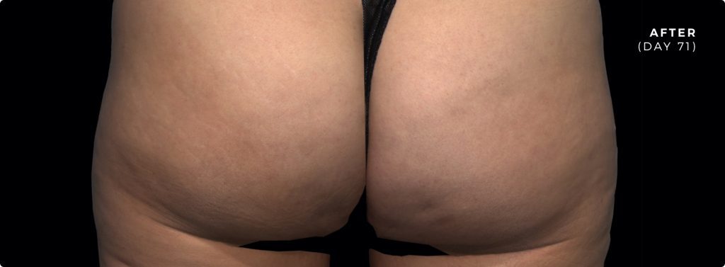 QWO Before_After 2 QWO Before_After 2