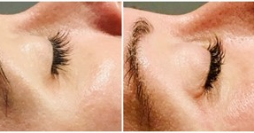 Before and After Lash Lift-Tint